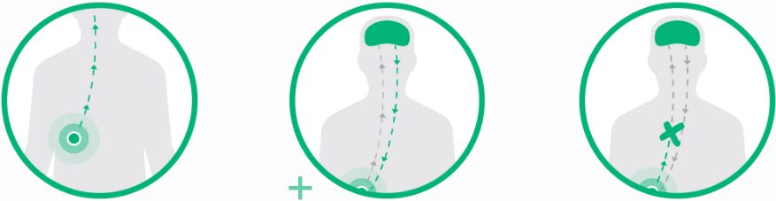 Pain Management HOW NuroKor® provides 100 natural pain relief – NuroKor UK