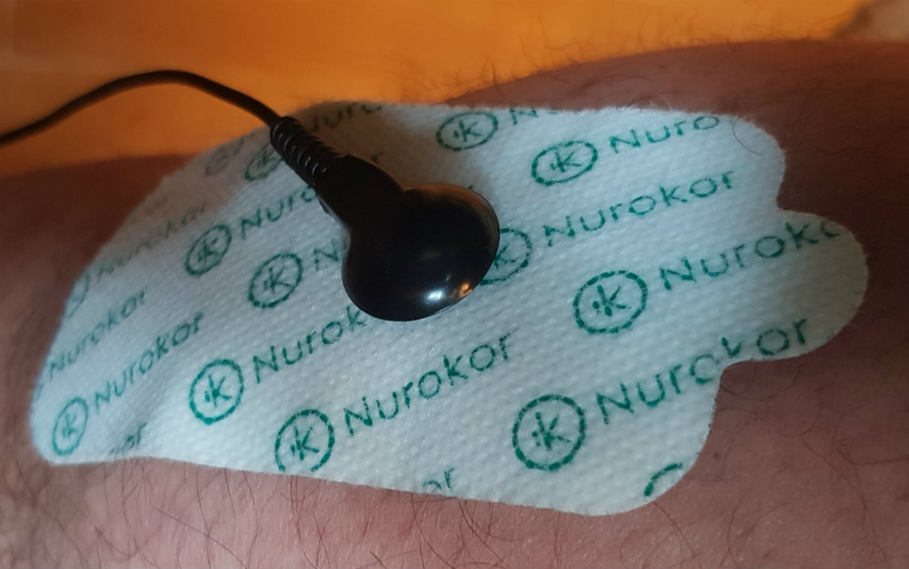 Review of Nurokor MiTouch Bioelectronic medicine for aches and injuries